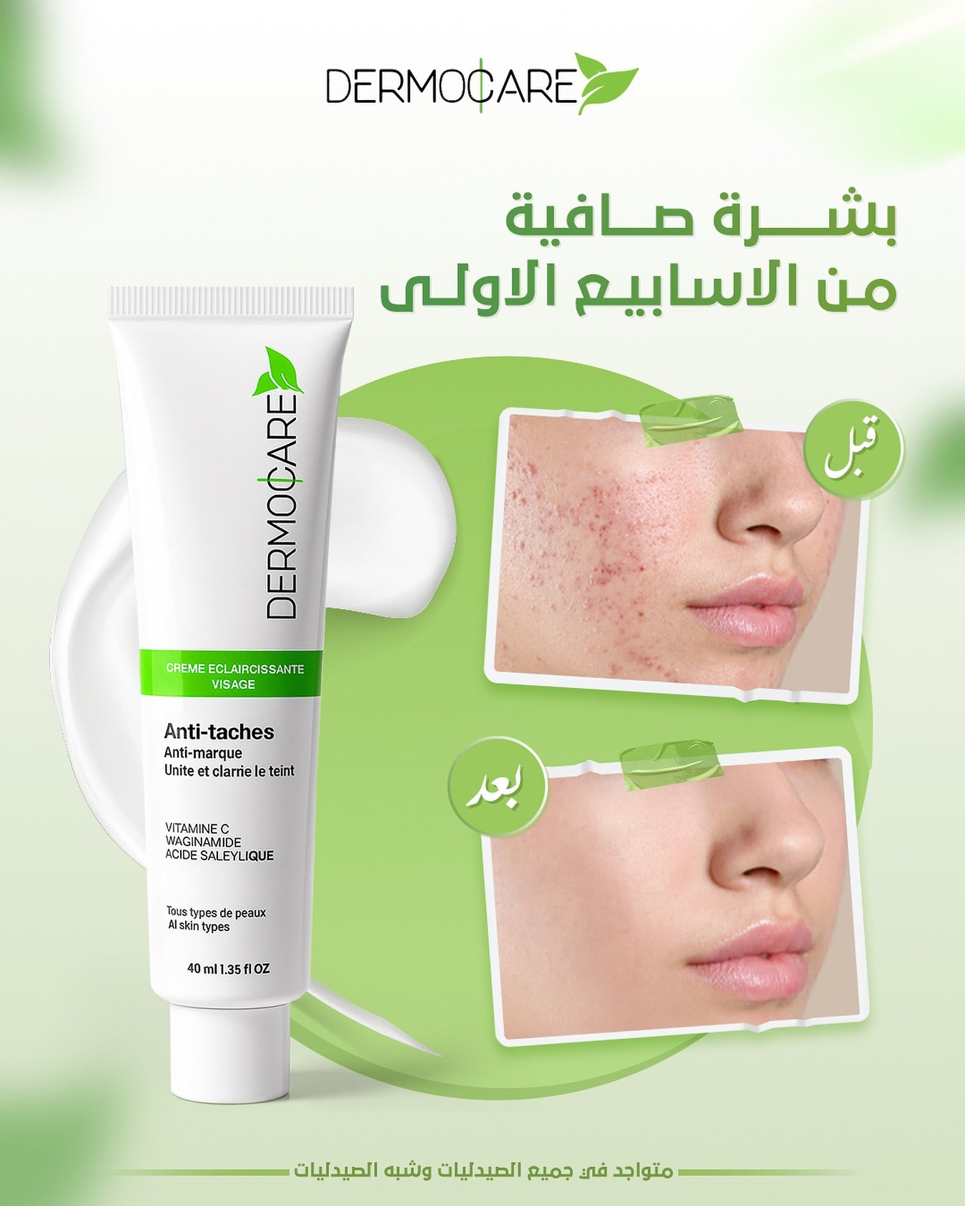 La crème anti-tache